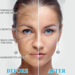 REDUCE TUS ARRUGAS - Serum Botox con Colageno ENVÍO GRATIS 🚚